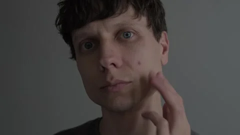 Acne and skin problem. Close up of man touching pimple on face, male skincare Stock Footage 327743268