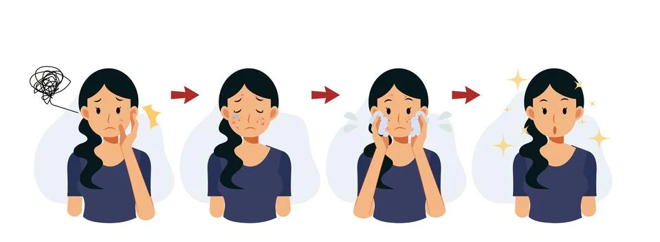 Acne concept.pimples. skin problems. step of Clear of acne. cleaning face.Fla Stock Illustration