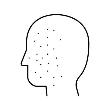 Acne disease line icon vector illustration Illustrazione stock