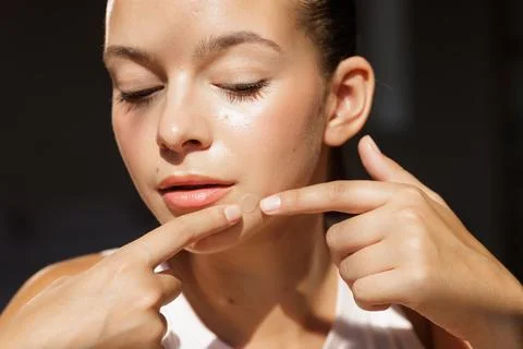 Acne Patch Application On Female Face With Problem Skin 스톡 사진
