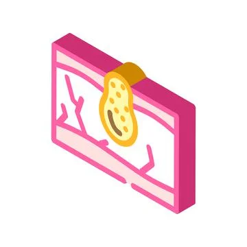 Acne skin problem isometric icon vector illustration Stock Illustration