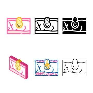 Acne skin problem multistyle color icon vector Stock Illustration