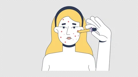 Acne treatment with serum applying 2D animation Stock Footage 309648201