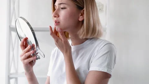 Acne treatment skin problem disturbed girl face Stock Footage 157606083