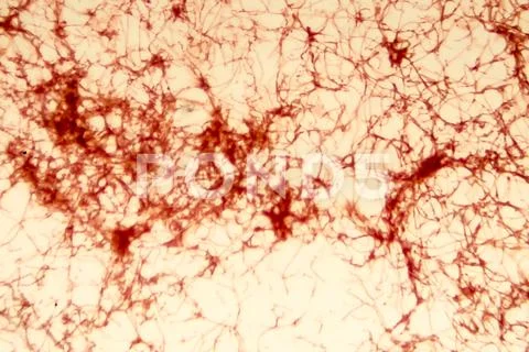 Actinomycetes, bacteria which resemble fungi, light micrograph Stock Photos