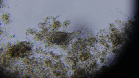 Activated sludge Stock Footage 82617292