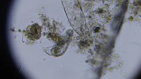 Activated sludge 動画素材 82617644