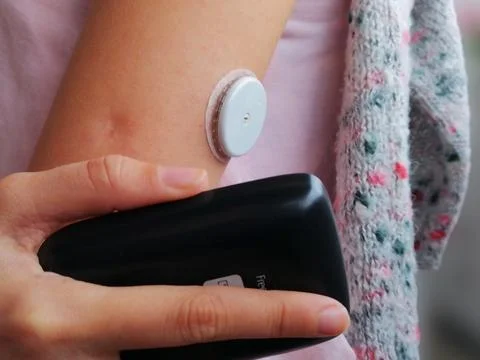 Activation and reading of sensor for continuous glucose monitoring – CGM Stock Photos