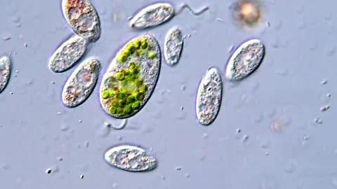 Active Ciliate Movement Captured Under Microscope, 400x 動画素材 317886980