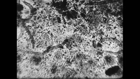Active Hookworm Parasites In Human Blood And Tissue Video stock 130721877