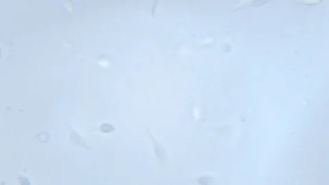 Active spermatozoa taken under a microscope with a magnification of 100x Stock Footage 107724152