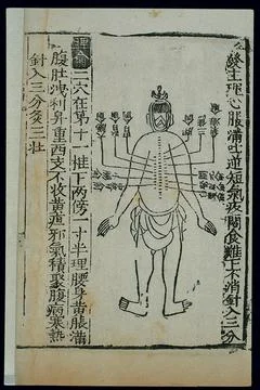 Acu-moxa chart, back of the prone figure, Chinese woodcut Stock Illustration
