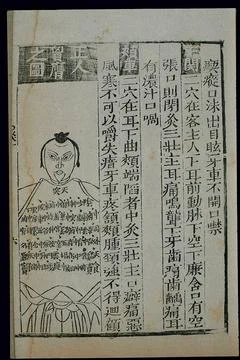 Acu-moxa chart, front of thorax, Chinese woodcut Stock Illustration