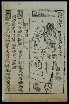 Acu-moxa chart, side of head and neck, Chinese woodcut Stock Illustration