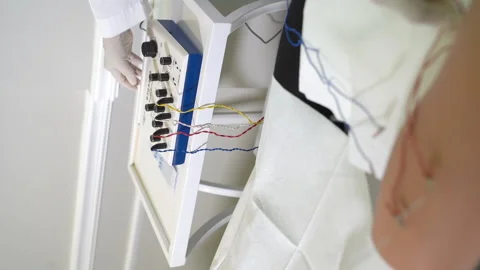 Acupuncture and current Video stock 140399543