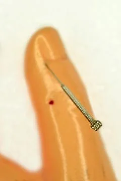 Acupuncture demonstration on hand model Stock Photos