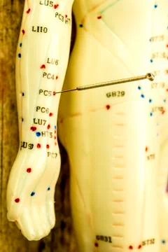 Acupuncture demonstration on model Stock Photos