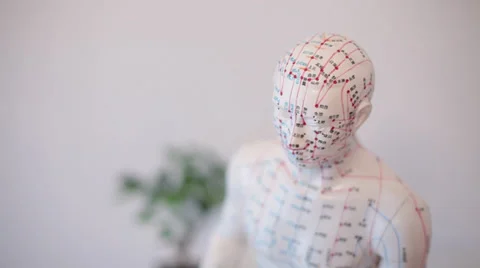 Acupuncture Stock Footage 28527380