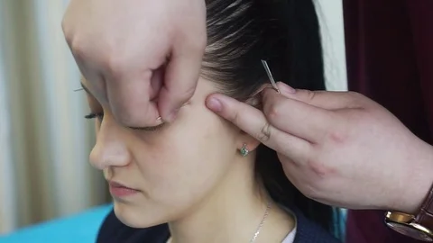 Acupuncture of the head and face. Stock Footage 81415753