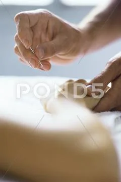 Acupuncture Needle Being Inserted In Patient's Hand