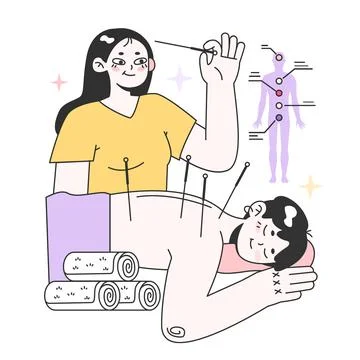 Acupuncture. Needle therapy, asian alternative medicine. Chinese medical Stock Illustration