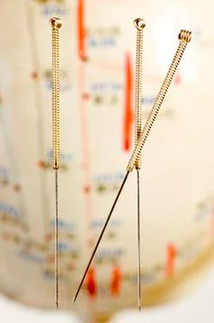 Acupuncture needles with head model 스톡 사진