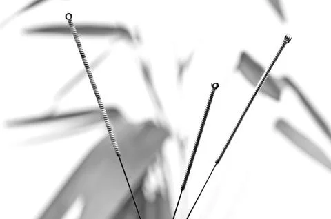 Acupuncture needles Stock Photos