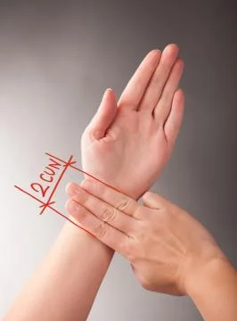 Acupuncture Stock Photos