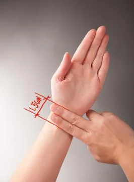 Acupuncture  Stock Photos