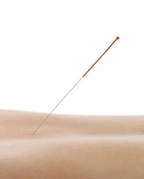 Acupuncture Stock Photos