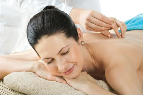 Acupuncture Foto stock
