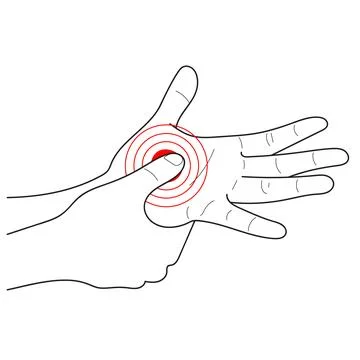 Acupuncture point on hand Stock Illustration