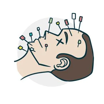 Acupuncture procedure on the face comics style Stock Illustration