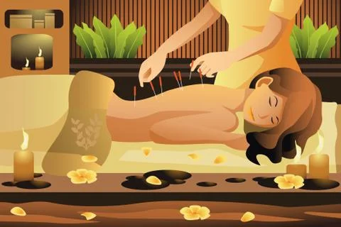 Acupuncture therapy Stock Illustration