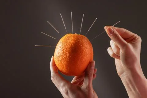 Acupuncture Training Concept Needles Inserted in Orange Fruit Alternative M.. Stock Photos