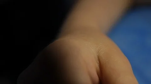 Acupuncture.Dry needling.A close-up of a needle sticking into a patient's wrist Stock Footage 116561429