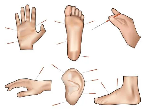 Acupuntcture vector illustration Stock Illustration