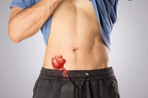 Acute appendicitis causing severe abdominal pain Stock Photos