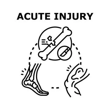Acute injury concept demonstrating bone fracture trauma Illustrazione stock