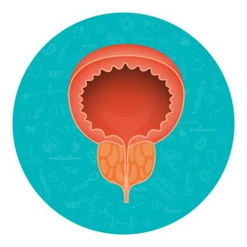 Acute prostatitis. Men s reproductive system disease. Medical vector Stock Illustration