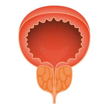 Acute prostatitis on white background. Men s reproductive system disease 스톡 일러스트