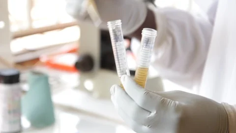 Adding urine samples into test tubes to be centrifuged 스톡 동영상 126444378