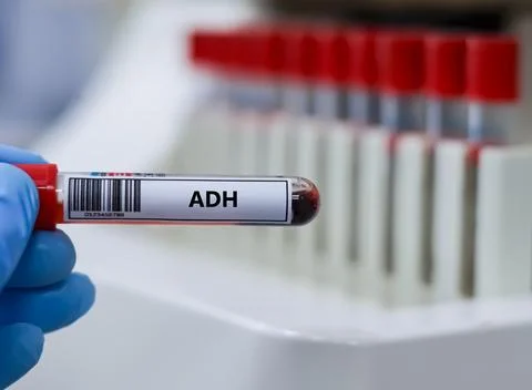 ADH 15 Stock Photos