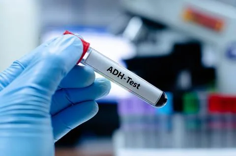 ADH-Test Stock Photos