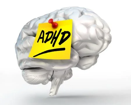 Adhd yellow note on brain Stock Illustration