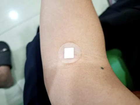 Adhesive medical patch applied on human arm skin for drug delivery or wound.. Stock Photos
