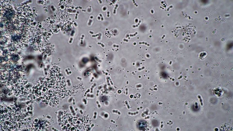 Adjusting the focus of the microscope on lacto bacteria and bacilli Stock Footage 126603437