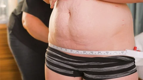 Adjusting tape on patients hips Video stock 107760294