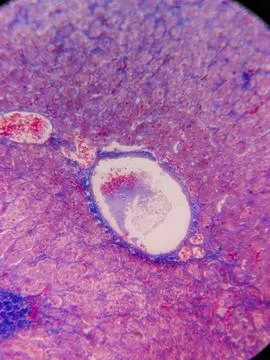 Adrenal Gland with Cortex and Medulla Stockfoto's