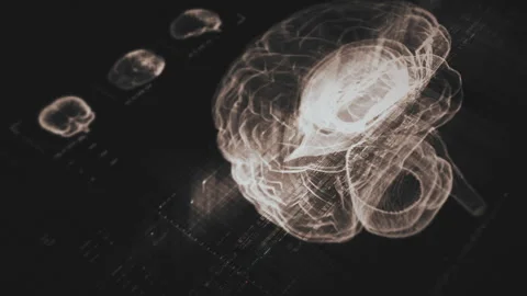 Advance Biomedical Neuron Pathology And Diagnostic Scan Stock Footage 310927140